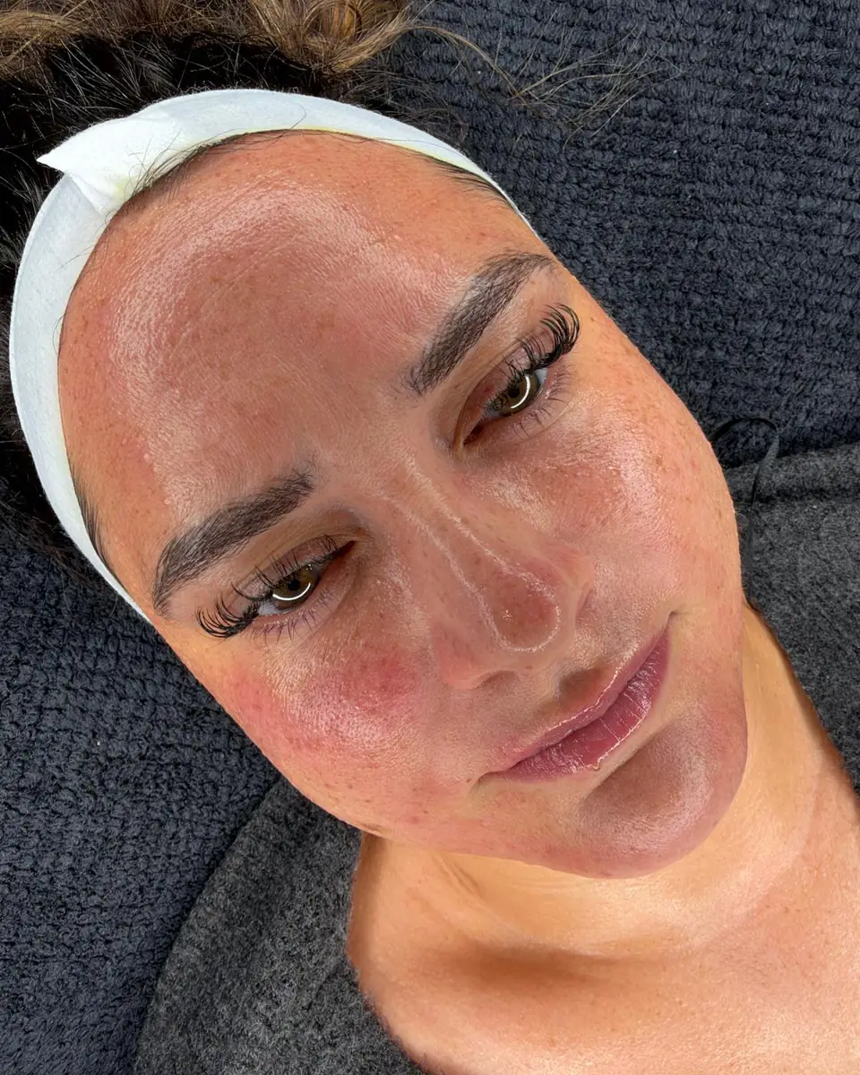 A client wearing a white headband, lying on a dark towel in the treatment room after a skin treatment